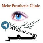 مركز تخصصي پروتز چشم مهر